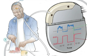 Illustration showing how a patient can control the device remotely.